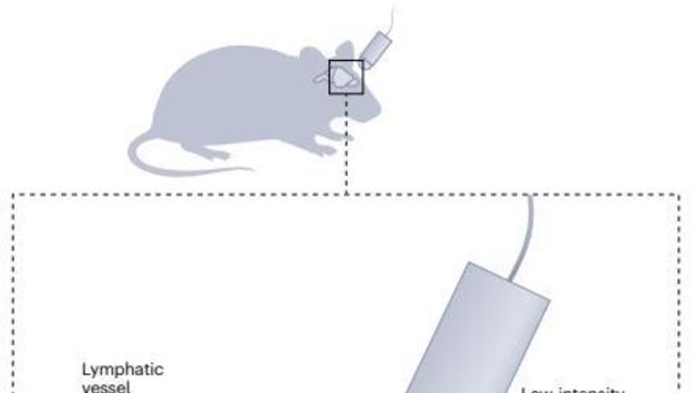 "초음파로 뇌졸중 쥐의 뇌 노폐물 제거…치매 등 치료 기대"