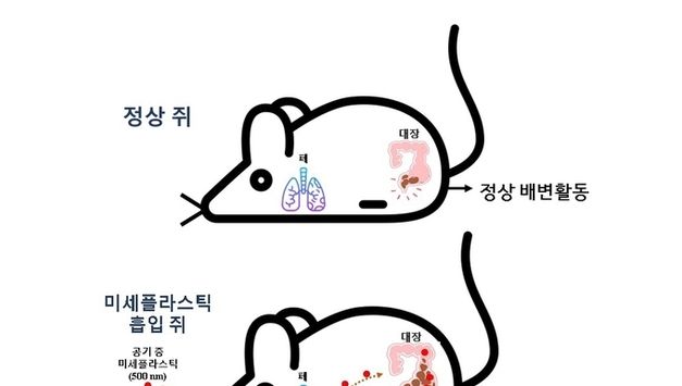 공기 흡입 미세플라스틱, 대장 이동 변비 유발 가능성