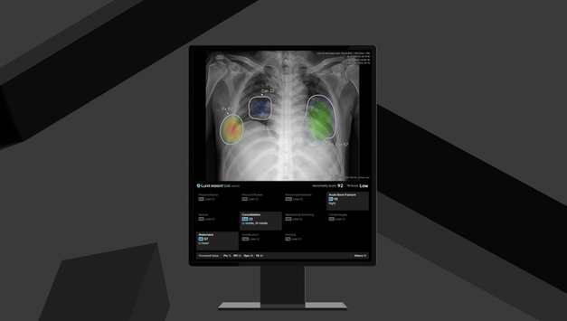 루닛, 국내 원격영상판독 센터에 AI 설루션 공급