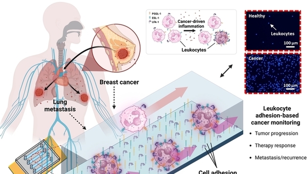 "백혈구 면역 반응으로 항암제 효과·재발 여부 확인"