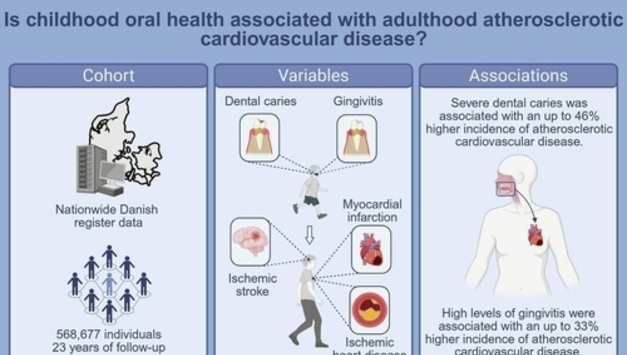 "어릴 때 충치·잇몸질환 있으면 성인기 심혈관질환 위험 증가"