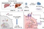 UNIST "비만 동반 간암 악화·항암제 내성 유발 원인 규명"