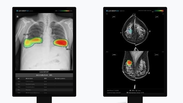 루닛, 유럽학회서 유방암·폐질환 AI 영상분석 연구 21편 발표