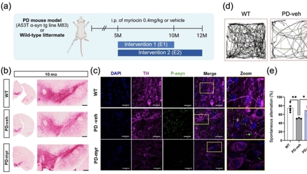 파킨슨병 늦추는 새 치료 전략 개발