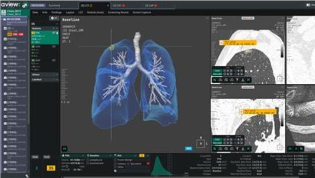 코어라인소프트, 독일 샤리테 대학병원에 흉부진단 AI 공급