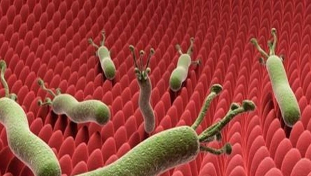 "헬리코박터균 없애도 비만이면 위암↑…55세 이후 제균자 주의"