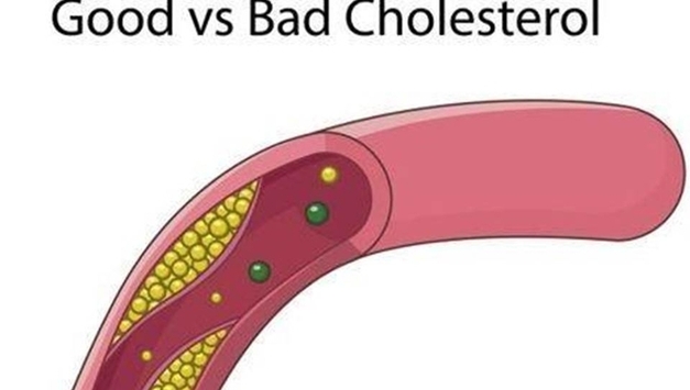 "콜레스테롤 수치 '기존보다 더 낮게' 관리하는 게 효과적"