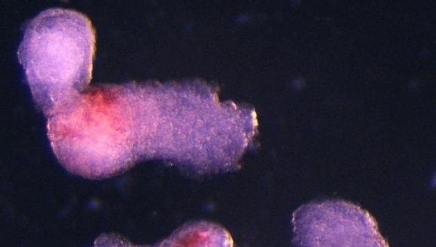 배아·태아 유전자 검사 가능 질환 6개 추가…총 249개