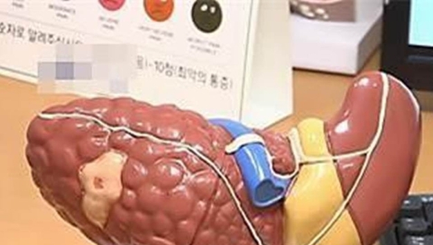 "지방간이 심장 혈관까지 막는다…심근경색 위험 높여"