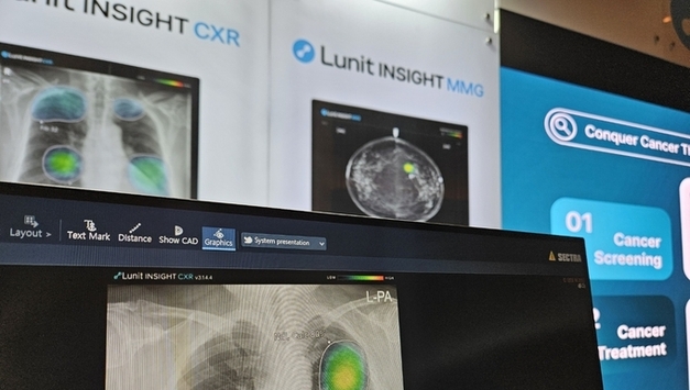 국내 최초 생성형 AI 기반 디지털의료기기 허가