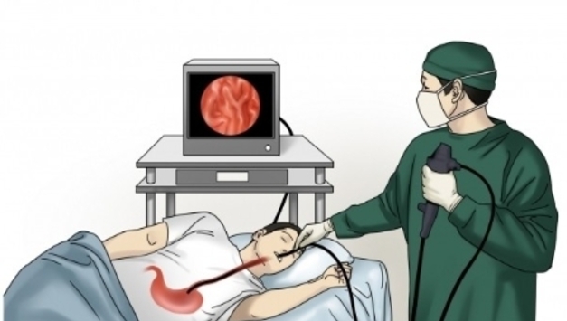 "위내시경 간격 3년 이내면 사망률 29 감소"