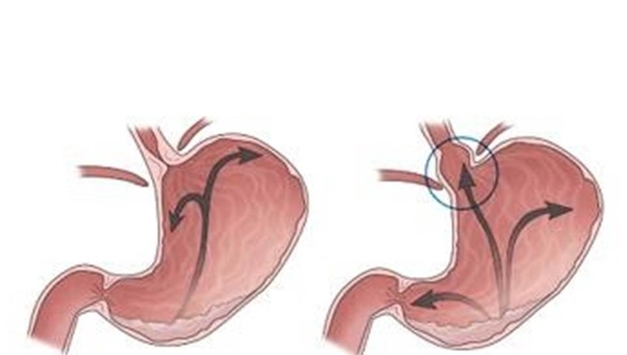 "1조원 시장 잡아라"…제약업계 위산 억제제 경쟁 가열