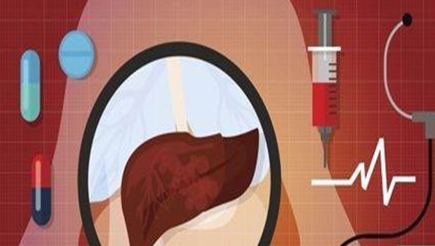 간암 1차 치료, 생존 2년 벽 넘본다