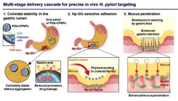 홍합처럼 '착' 붙는다…위암 원인균 잡는 나노입자 개발