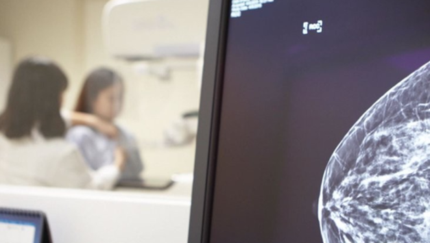 "유방암 치료제 투여 전 '심장 부작용' 고위험군 예측 가능"