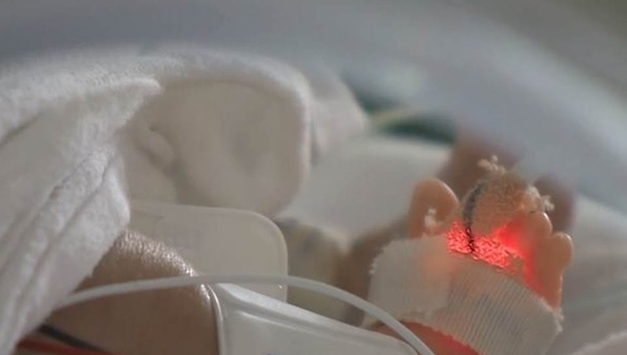 '미숙아 최대 2천만원' 영유아 치료비 지원↑…"보건소에 신청"