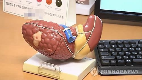 지방간<br>
연합뉴스TV 캡처. 작성 김선영(미디어 랩)