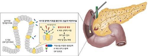 비만 대사성 질환에 대한 광역학 치료 개념도<br>
[한국연구재단 제공. 재판매 및 DB 금지