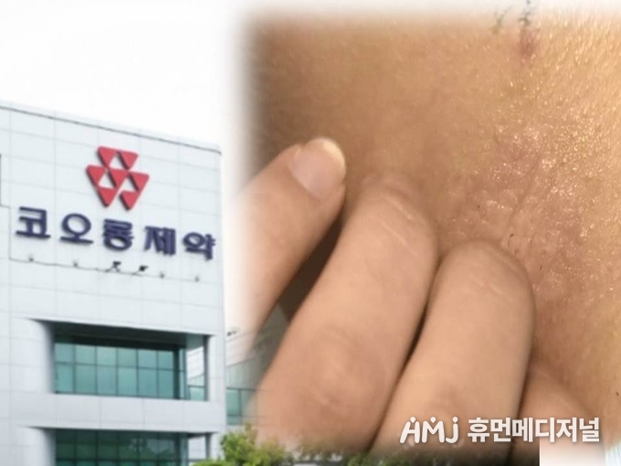 건선