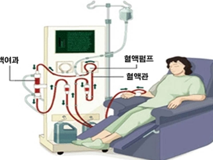 혈액투석