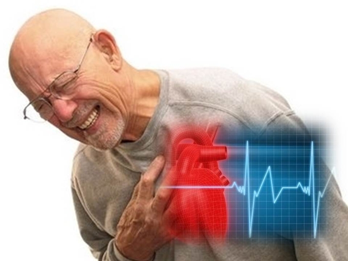 심근경색