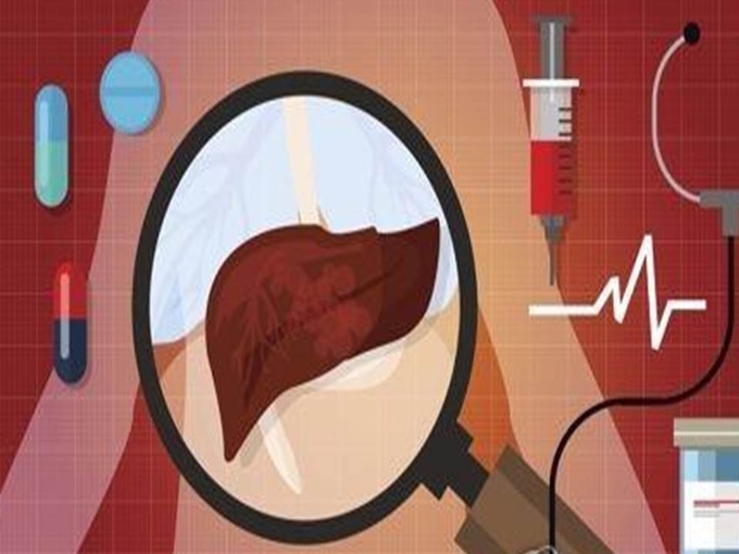 <strong>"간암 환자 수술 전후 방사선 치료하면 생존율·완치율↑"</strong><br>
게티이미지뱅크 제공
