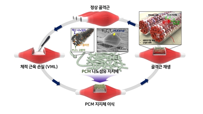 <strong>맥신 나노섬유 지지체를 활용한 체적 근육 손실 재생 모식도</strong>[부산대학교 제공[